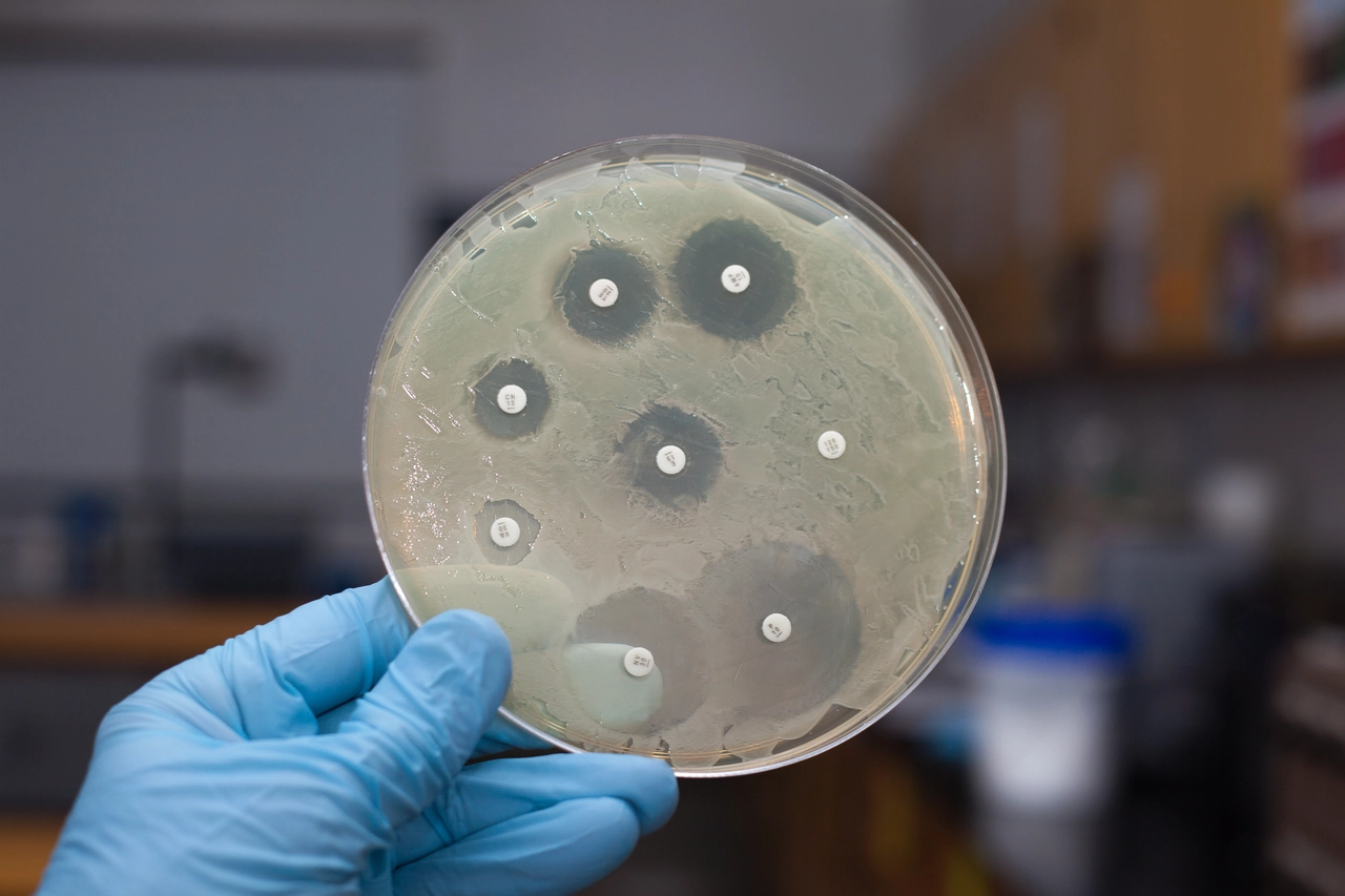 Come riconoscere una malattia rara: segnali da non ignorare