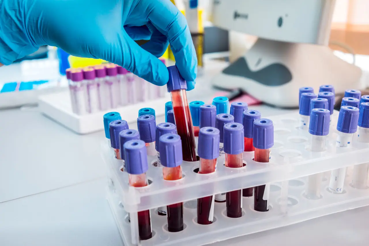Analisi metaboliche: guida ai costi e ai consigli utili per la salute