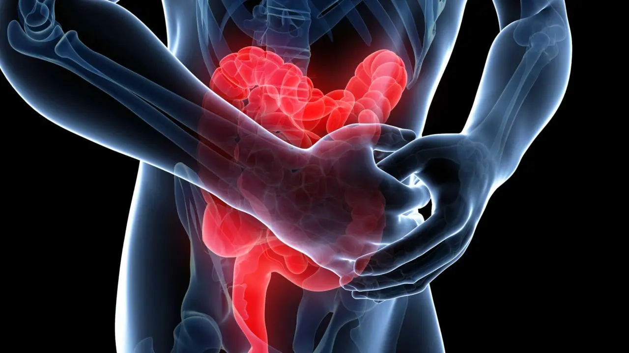 Colon irritabile: ecco la lista dei 5 cibi peggiori